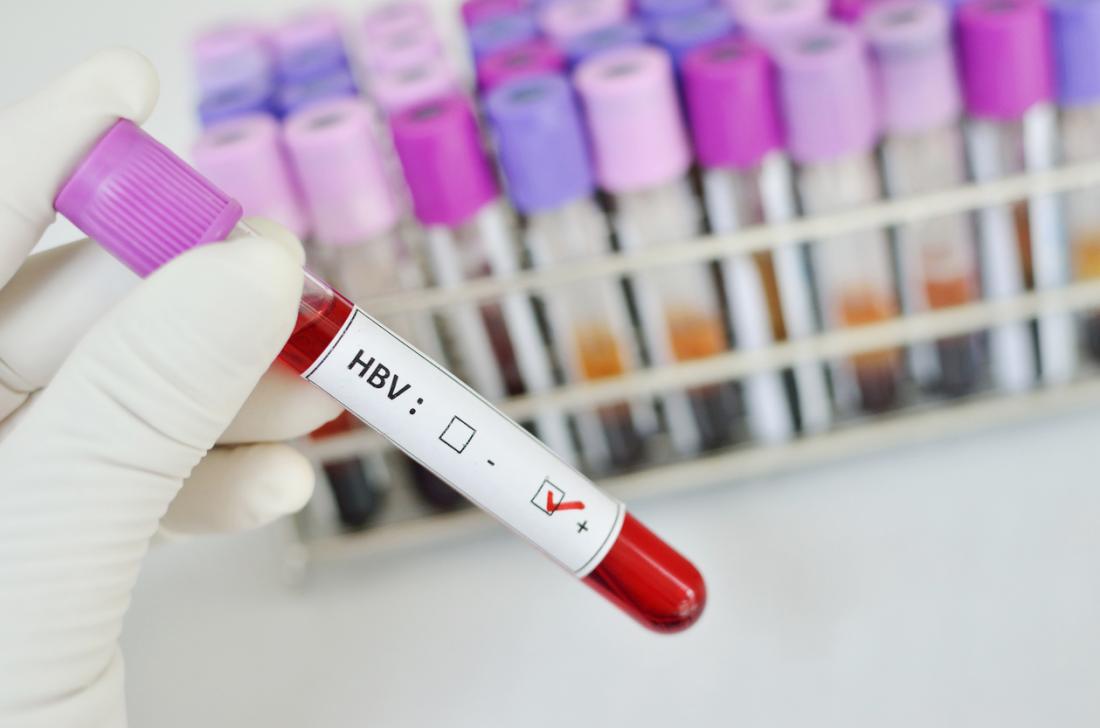Foto: Medical News Today