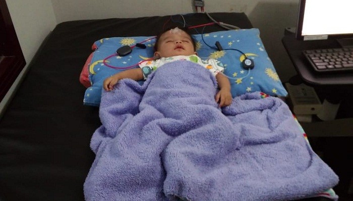 Alifa Qalesya Barizah, seorang balita berusia 2 tahun asal Kuningan yang terkena virus Congenital Rubella Syndrom (CRS). Foto: Istimewa