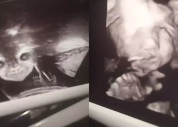 Seorang ibu hamil terkejut melihat hasil USG kandungannya karena bayinya terlihat seperti bayi iblis. Foto: Ladbible