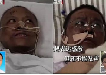 2 dokter di Wuhan sembuh dari Covid-19, namun kulit mereka jadi menghitam. Foto: CCTV