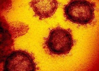 Gambar mikroskop elektron transmisi menunjukkan coronavirus baru yang muncul dari permukaan sel manusia. Foto: Kompas.com