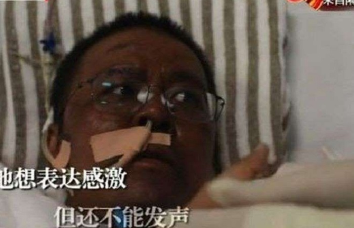 Dr Hu Weifeng, dokter di Wuhan yang menjadi viral pada April setelah kulitnya menghitam dikarenakan pengobatan virus corona. Dia meninggal pada Selasa (2/6/2020) setelah lima bulan berjuang. Foto: CCTV