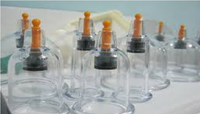 Bekam dalam Islam prosedur pengobatan tradisional Nabi Muhammad SAW